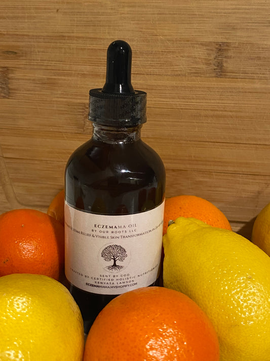 Eczemama Psoriasis Scalp Oil